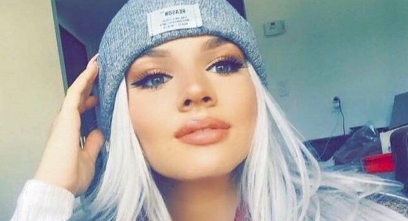 Shirin David: Hat sich die YouTuberin ihre Lippen aufspritzen lassen?
