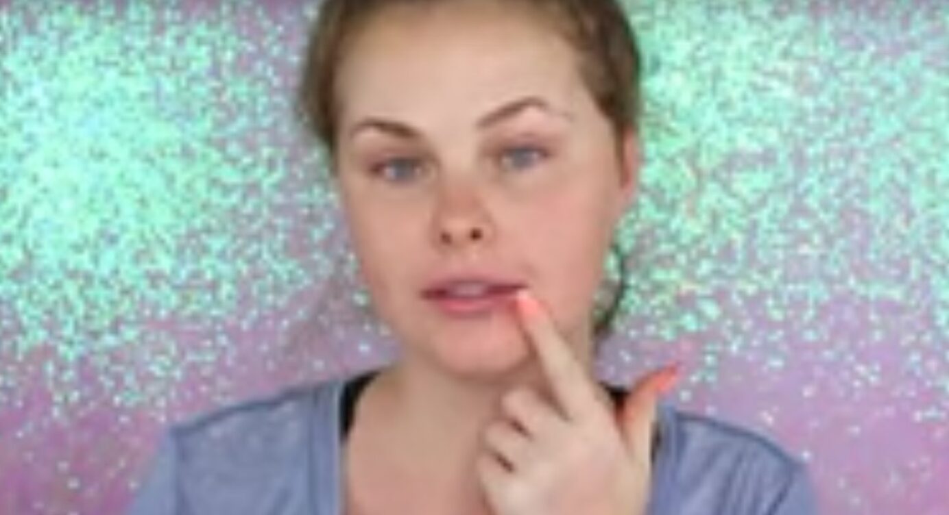 Schock! Gehirntumor bei YouTuberin entdeckt